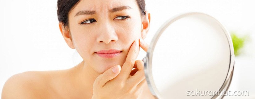 Tại sao mặt bị sưng khi dùng kem trị mụn?