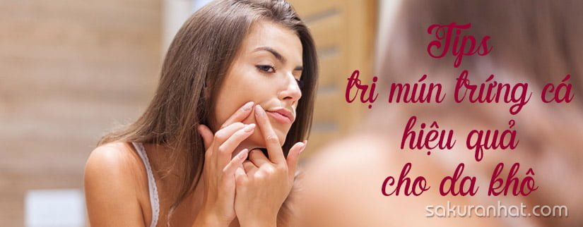 Tips trị mụn trứng cá hiệu quả cho da khô