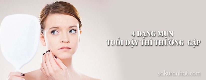 Các loại mụn thường gặp ở lứa tuổi dậy thì